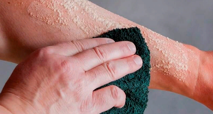 How to clean the burn